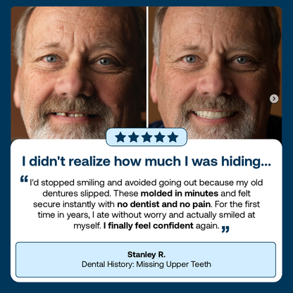 Lab Quality Self-Fitting Full Custom Dentures