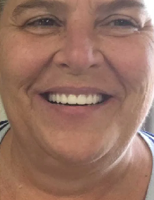 After image for Melissa Turner