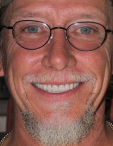 After image for Thomas Ferrer