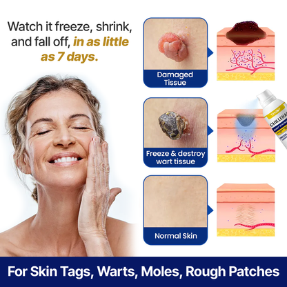 Timilk ChillErase® Bump Renewal Spray